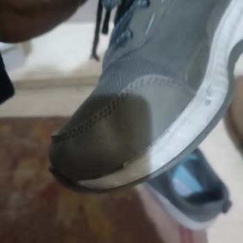 Skechers Yırtılan Ayakkabı Kullanıcı Hatasıymış
