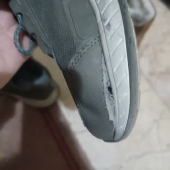 Skechers Yırtılan Ayakkabı Kullanıcı Hatasıymış