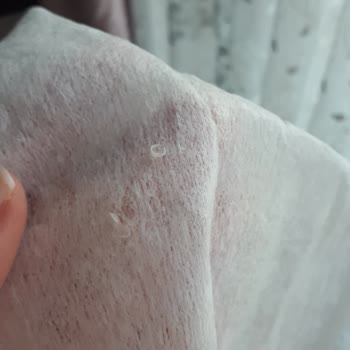 Uni Baby Yenidoğan Islak Mendilde Çıkan Plastik Parçaları!