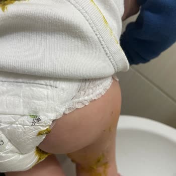 Sleepy Külot Bez Pişmanlıktır. Aldığıma Pişmanım. Değişim İstiyorum.