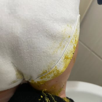 Sleepy Külot Bez Pişmanlıktır. Aldığıma Pişmanım. Değişim İstiyorum.