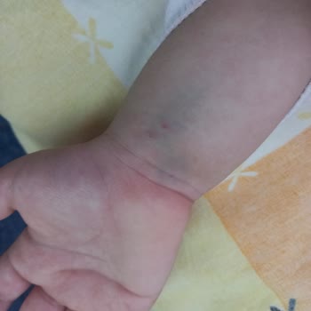 İzmir Bayraklı Şehir Hastanesi Bayraklı Çocuk Acil Büyük Felaket