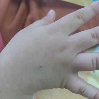 İzmir Bayraklı Şehir Hastanesi Bayraklı Çocuk Acil Büyük Felaket