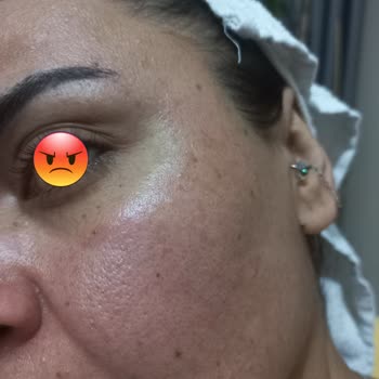 Bioderma Pigmentbio Leke Serisi