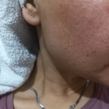 Bioderma Pigmentbio Leke Serisi