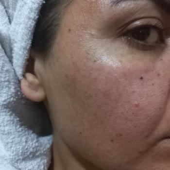 Bioderma Pigmentbio Leke Serisi