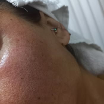 Bioderma Pigmentbio Leke Serisi