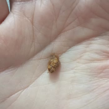 Çizmeci Gıda İçinden Sert Dikenli Madde Çıktı