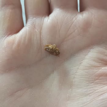 Çizmeci Gıda İçinden Sert Dikenli Madde Çıktı