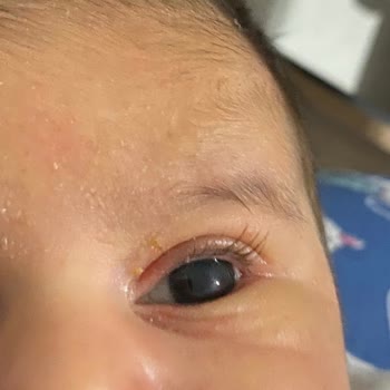 Mustela Vücut Yağı Etkisi