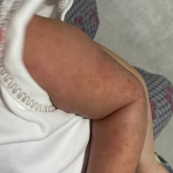 Mustela Vücut Yağı Etkisi