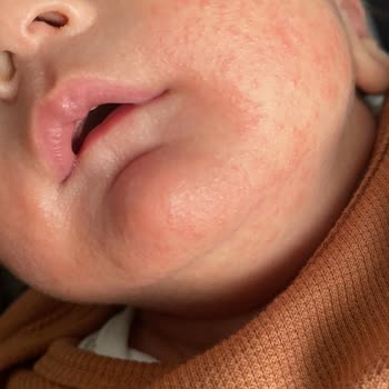Mustela Vücut Yağı Etkisi