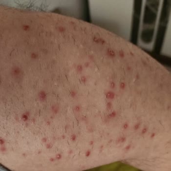 Veet Tüy Dökücü Krem