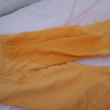 Molfix Kalitesiz Bebek Bezi Ve Sızıntı Sorunu