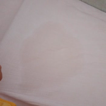 Molfix Kalitesiz Bebek Bezi Ve Sızıntı Sorunu