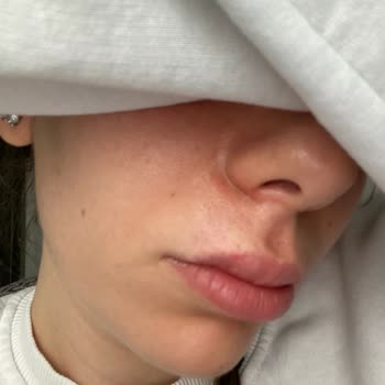 Cream Co. Creem.co Alerji İçerik Değişikliği