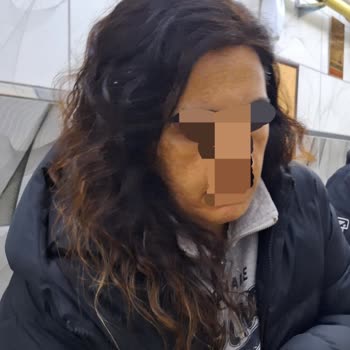 Samsung A54 Kamera Renk Dengesizliği