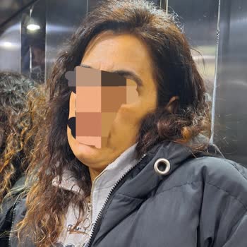 Samsung A54 Kamera Renk Dengesizliği