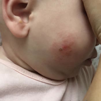 Mustela Stelatopia Şampuan Alerji Yapıyor!