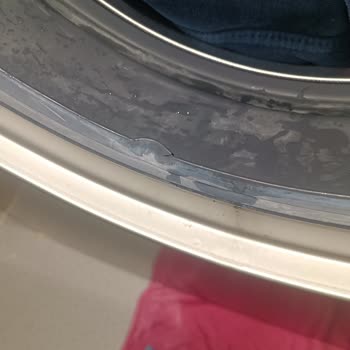 Siemens Kronik Körük Sorunu