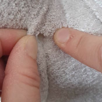 Mondi Defolu Ürün Ve Servis Sıkıntısı