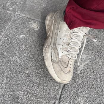 Trendyol Ürün 8 Ayda Mahvoldu Orjinalliğinden Şüphem Var