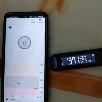 Dexcom Ölçüm Sensöründe Sıkıntı Var!