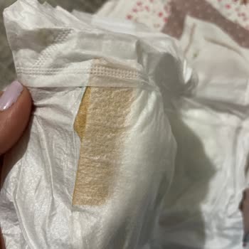 Baby Turco Hatalı Bez Çıktı