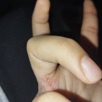 BİM Yaralar Çıkması Plastik Cam