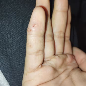 BİM Yaralar Çıkması Plastik Cam