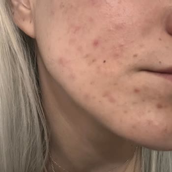 Caudalie Gece Gündüz Kremi Vakası