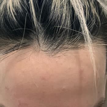 Caudalie Gece Gündüz Kremi Vakası