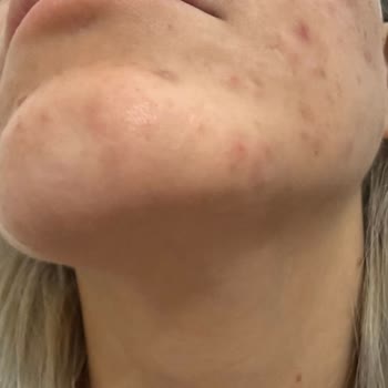 Caudalie Gece Gündüz Kremi Vakası