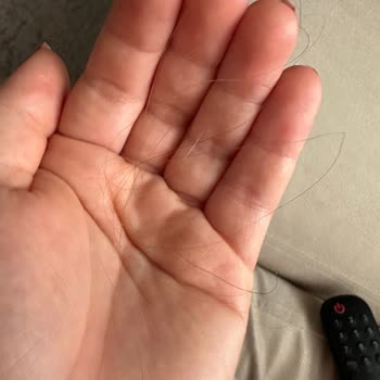 Elidor Keratin Bakım Saç Dökülmesi Yaptı