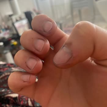 Palette Saç Boyası Her Yeri Mahvetti