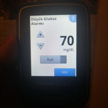 Freestyle Libre 2 Sensör Alarm Sorunu