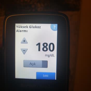 Freestyle Libre 2 Sensör Alarm Sorunu