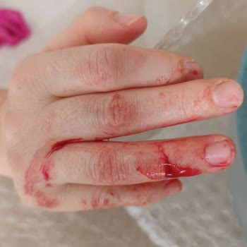 A101 Kırık Ürün Gönderimi Paketleme Sorunu