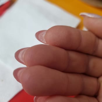 Aymira Koçaklı Yaşam Merkezi Yaşam Merkezinde Uzun Bekleme Süresi Ve Fiyatlandırma Sorunu