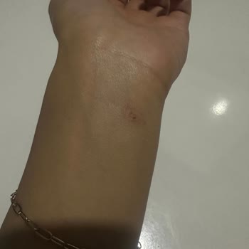 Dermoskin Fondöten Alerji Yaptı