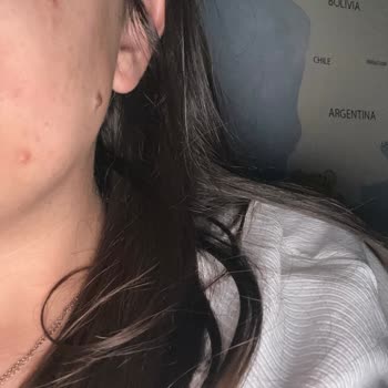 Yves Rocher Tonik Yüzümü Deforme Etti