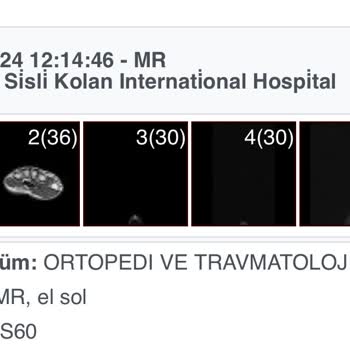 Kolan Hospital Hastane Randevu Ve İletişim Sorunu