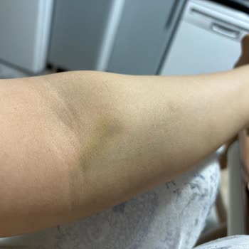 Buhara Hastanesi Aşırı Acemi Veya Özensiz Çalışanları