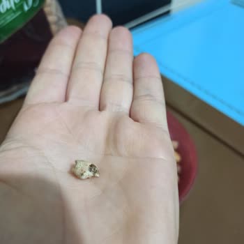 A101 Çerezya Fıstığında Salyangoz Kabuğu Çıktı