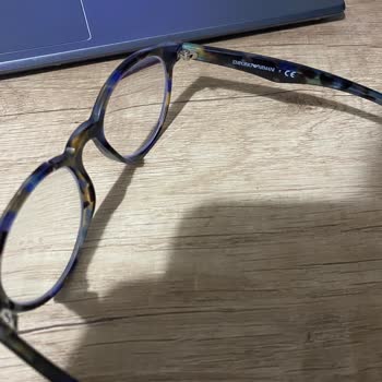 Atasun Optik Kırılan Gözlük Çerçevesi Ve İlgisiz Çalışanlar