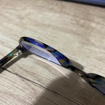 Atasun Optik Kırılan Gözlük Çerçevesi Ve İlgisiz Çalışanlar