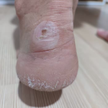 Camper Ayakkabısının Arkasında Durmuyor