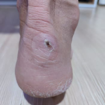 Camper Ayakkabısının Arkasında Durmuyor