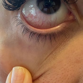 Başak Aktay Güzellik Hayal Kırıklığı Oldu