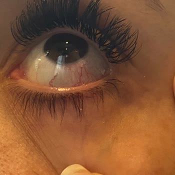 Başak Aktay Güzellik Hayal Kırıklığı Oldu